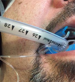 Odoo - Prueba 3 a tres columnas