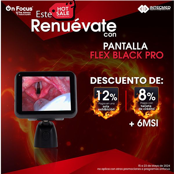 Odoo - Prueba 1 a tres columnas