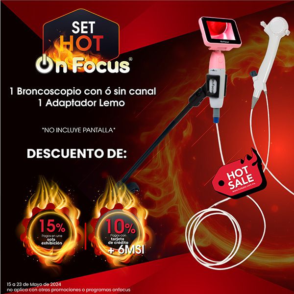 Odoo - Prueba 3 a tres columnas